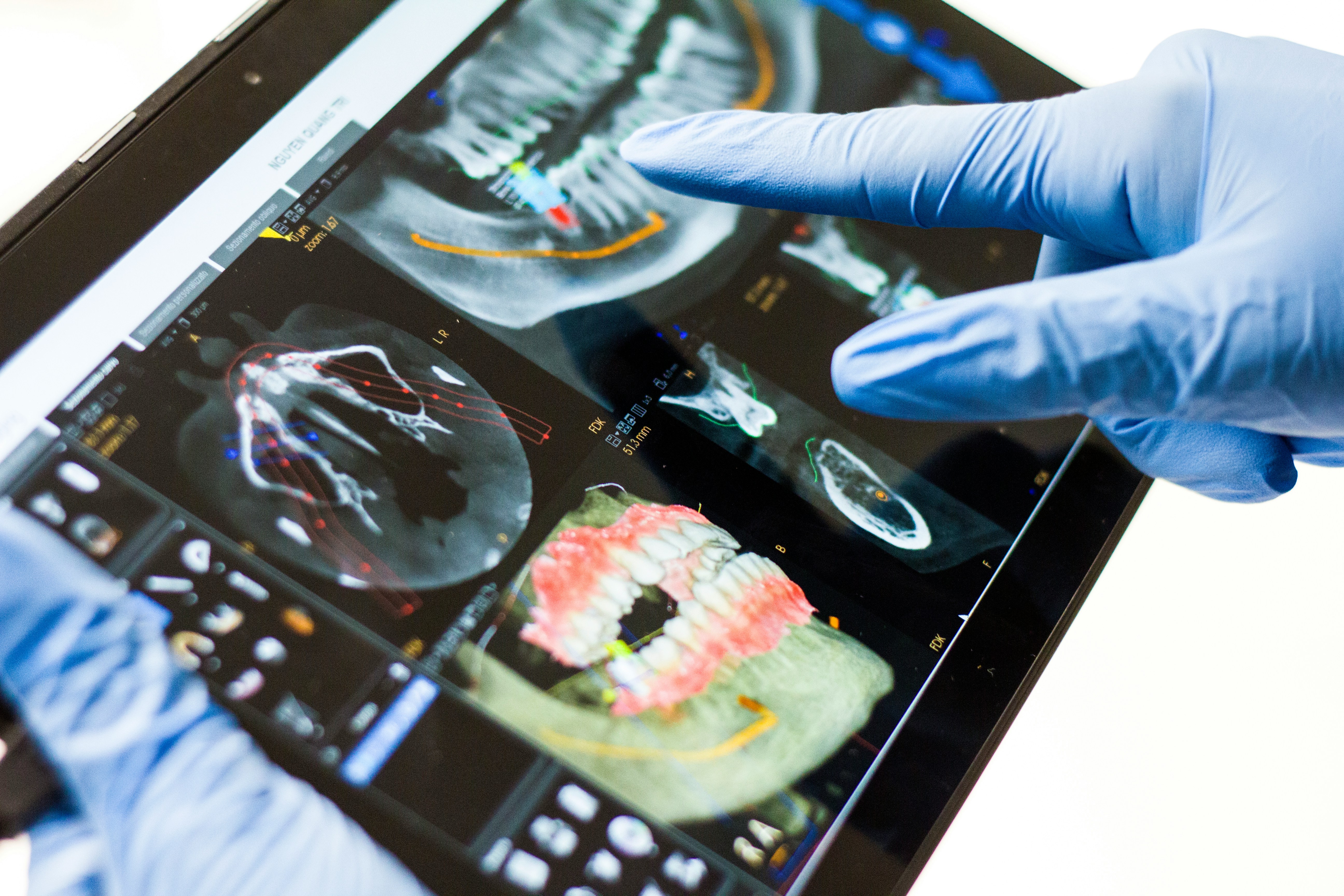 Dental technology