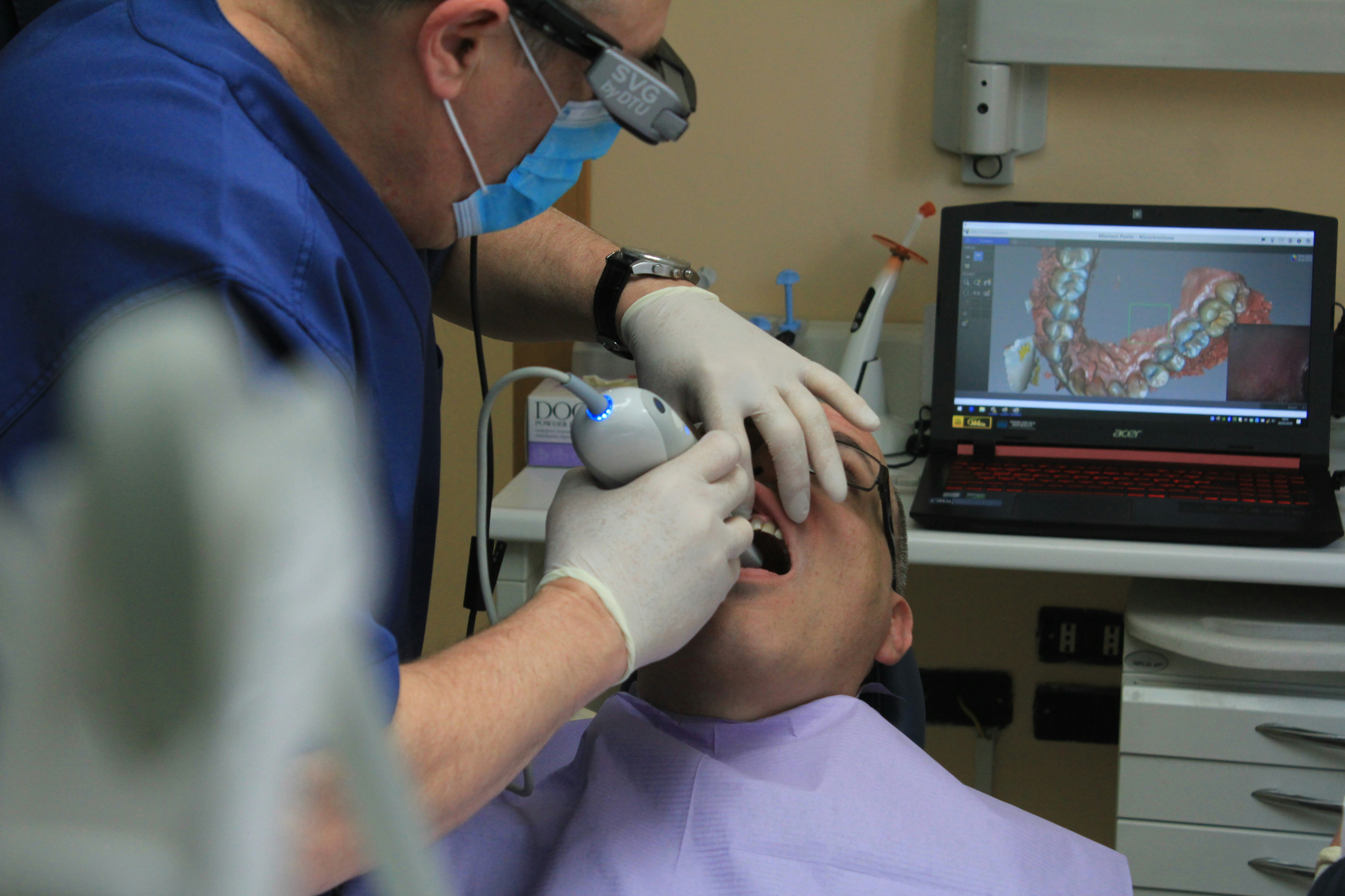 Intra Oral Scanning